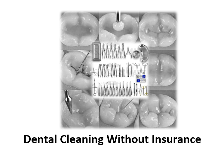 Dental Cleaning Without Insurance