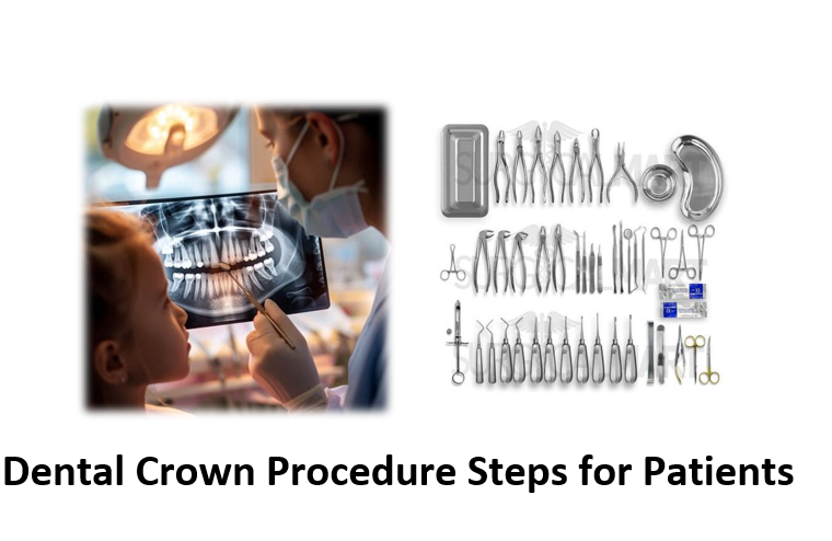 Dental Crown Procedure Steps for Patients